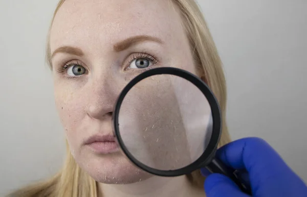 女性は顔に乾いた肌を検査する 皮むき 不快感 皮膚感度 皮膚科医または美容師の任命で患者 乾燥のためのクリームの選択 — ストック写真