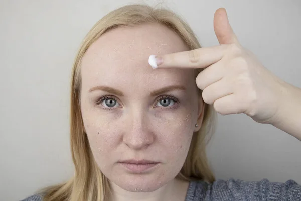 女性は顔に乾いた肌を検査する 皮むき 不快感 皮膚感度 皮膚科医または美容師の任命で患者 乾燥のためのクリームの選択 — ストック写真
