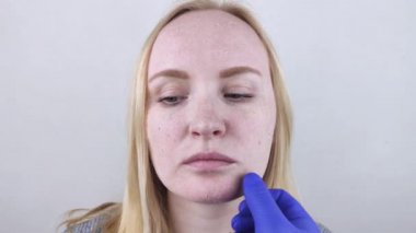 Mavi eldivenli bir doktor cildindeki hasarı belirlemek için hastalara dokunur. Dermatolog ya da kozmetikçinin randevusundaki hasta, kuruluk için krem seçimi.