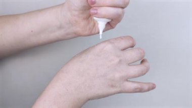 Kız ellerinin üstüne kurumuş ciltten krem döker ve ovalar. Ellerin kuru deri parçalarıyla dolu olduğu makro bir video. Kız ellerini bir doktor dermatoloğa gösteriyor. Elleri nemlendiriyor ve parmaklardaki mantarı tedavi ediyor.