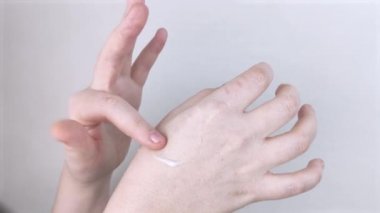 Kız ellerinin üstüne kurumuş ciltten krem döker ve ovalar. Ellerin kuru deri parçalarıyla dolu olduğu makro bir video. Kız ellerini bir doktor dermatoloğa gösteriyor. Elleri nemlendiriyor ve parmaklardaki mantarı tedavi ediyor.