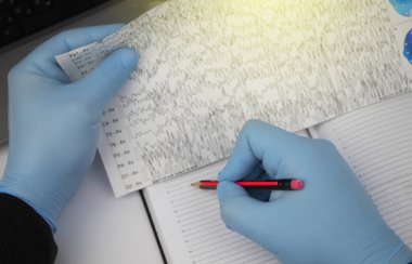 Bir nörolog hasta beyninin ensefalogramını inceler. Elektroensefalogram programı, epilepsi belirtileri ve sinir sisteminin patolojileri için beyin akımlarını incelemek.