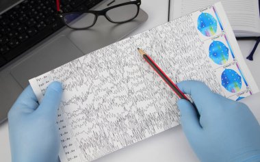 Bir nörolog hasta beyninin ensefalogramını inceler. Elektroensefalogram programı, epilepsi belirtileri ve sinir sisteminin patolojileri için beyin akımlarını incelemek.