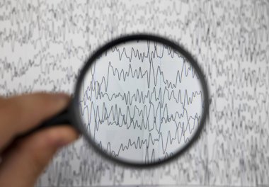 Bir nörolog hasta beyninin ensefalogramını inceler. Elektroensefalogram programı, epilepsi belirtileri ve sinir sisteminin patolojileri için beyin akımlarını incelemek.