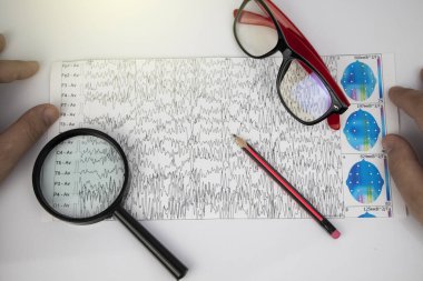 Bir nörolog hasta beyninin ensefalogramını inceler. Elektroensefalogram programı, epilepsi belirtileri ve sinir sisteminin patolojileri için beyin akımlarını incelemek.