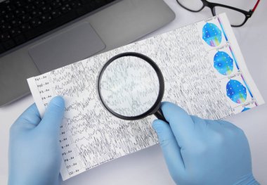 Bir nörolog hasta beyninin ensefalogramını inceler. Elektroensefalogram programı, epilepsi belirtileri ve sinir sisteminin patolojileri için beyin akımlarını incelemek.