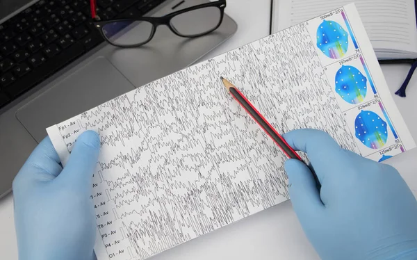 A neurologist examines an encephalogram of a patients brain. Schedule of electroencephalograms, study of brain currents for signs of epilepsy and pathologies of the nervous system