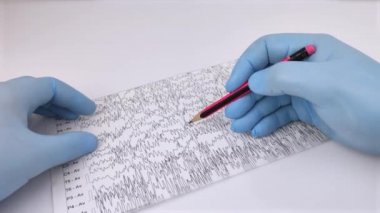 Bir nörolog hasta beyninin ensefalogramını inceler. Elektroensefalogram programı, epilepsi belirtileri ve sinir sisteminin patolojileri için beyin akımlarını incelemek.