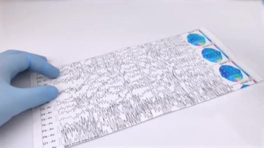 Bir nörolog hasta beyninin ensefalogramını inceler. Elektroensefalogram programı, epilepsi belirtileri ve sinir sisteminin patolojileri için beyin akımlarını incelemek.