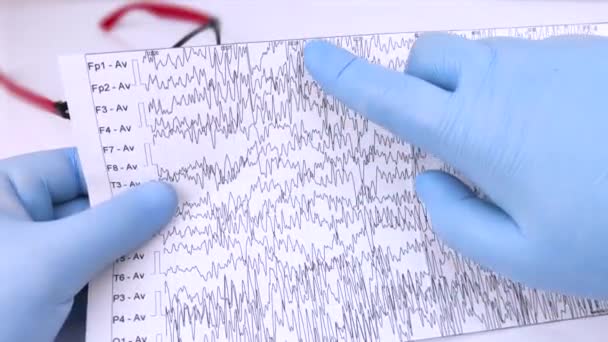 Neurolog Undersöker Ett Encefalogram Patienthjärna Schema Över Elektroencefalogram Studier Hjärnströmmar — Stockvideo