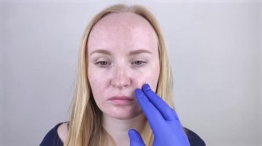 Mavi eldivenli bir dermatolog yağlı cildini muayene ediyor. Yağlı ve sorunlu cilt. Sivilceli, yağlı ciltli ve pigmentasyonlu sarışın bir kızın portresi..