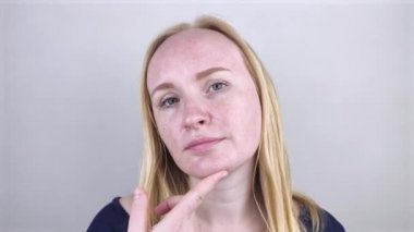 Üzgün bir kız aynaya bakar ve yağlı deriyi görür. Yağlı ve sorunlu cilt. Sivilceli, yağlı ciltli ve pigmentasyonlu sarışın bir kızın portresi.. 