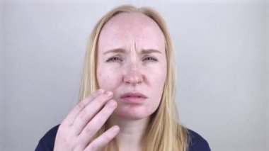 Üzgün bir kız aynaya bakar ve yağlı deriyi görür. Yağlı ve sorunlu cilt. Sivilceli, yağlı ciltli ve pigmentasyonlu sarışın bir kızın portresi.. 