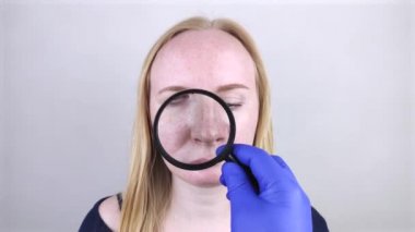 Bir cildiyeci, hastanın büyümüş gözeneklerini ve yağlı cildini incelemek için bir büyüteç kullanır. Yağlı ve sorunlu cilt. Sivilceli, yağlı ciltli ve pigmentasyonlu sarışın bir kızın portresi..