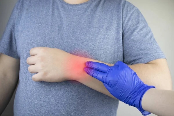 男人的手腕受伤了创伤学家检查手部 肠胃疼痛作为隧道综合征或扭伤 肌腱退变 关节炎的症状 — 图库照片