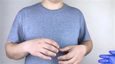 Parkinson hastalığı olan bir hastanın elleri titriyor. Çeşitli hastalıklarda el ve ayakların titremesi. Hasta bakımı konsepti.