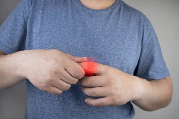 Man Grows Fingers Hurt Pull Arthritis Arthrosis Joints Its Treatment — Stock Photo, Image
