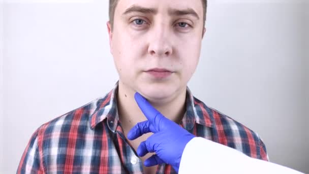 Homem Tem Segundo Queixo Conceito Obesidade Cirurgia Plástica Face Close — Vídeo de Stock