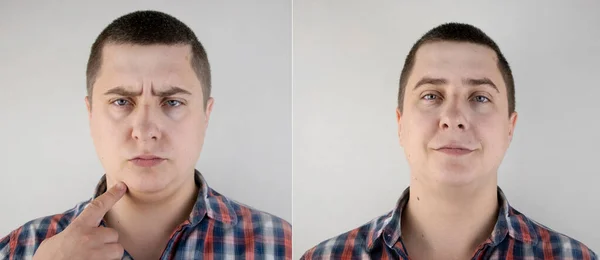 Man Has Second Chin Photos Plastic Surgery Face Close Patient — Stock Photo, Image