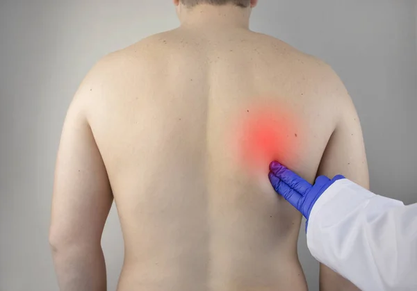 Shoulder Pain Man Doctors Appointment Vertebrologist Complaining Pain Interscapular Region — Stock Photo, Image