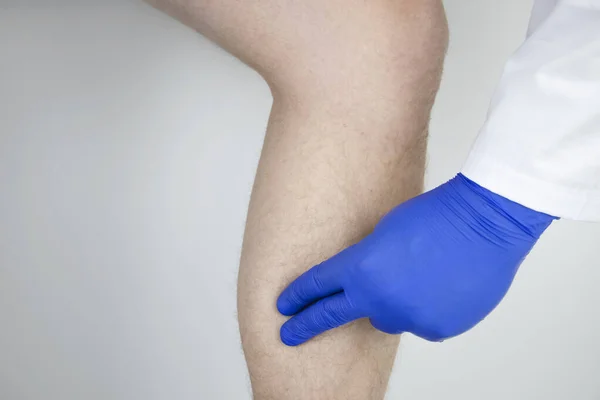 A man suffers from pain in the calves. Stretching the calf muscle, varicose veins, leg cramps, or myositis. Orthopedic doctor examines — Stock Image Man Suffers Pain Calves Stretching Calf Muscle Varicose Veins Leg Stock Picture