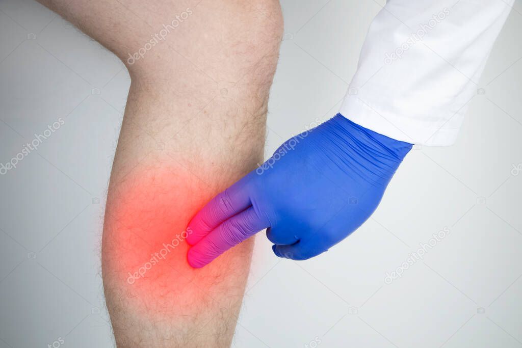 A man suffers from pain in the calves. Stretching the calf muscle, varicose veins, leg cramps, or myositis. Orthopedic doctor examines