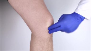 Bir adam diz ağrısından muzdarip. Bir ortopedist ve travmatolog tarafından muayene. Bacaklarda kızarıklık ve şişkinlik, menisküs yırtılması veya diz kesesi iltihabı.