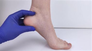 Bir ortopedi doktoru bir kadının bacağını muayene eder. Topuk ağrısı, tendon gerilmesi, iltihap, topuk çıkıntısı. Ayak Hastalığı Tedavisi Konsepti 