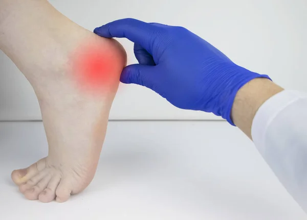 Bir ortopedi doktoru bir kadının bacağını muayene eder. Topuk ağrısı, tendon gerilmesi, iltihap, topuk çıkıntısı. Ayak Hastalığı Tedavisi Konsepti