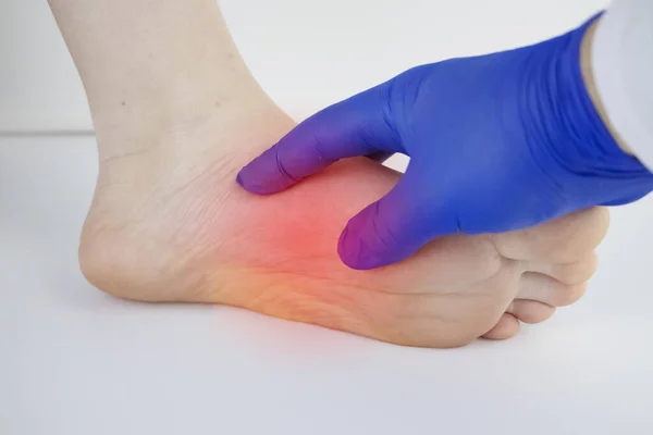 Врач Ортопед Осматривает Ногу Женщины Боль Пятке Растяжение Сухожилий Воспаление — стоковое фото