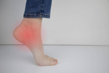 Woman suffering from heel pain. Inflammation or sprain of the tendon in the foot, heel spur, bursitis. The concept of diseases and pains in the leg clipart