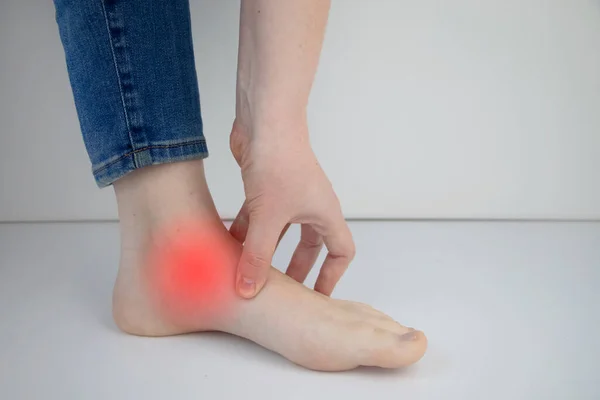脚后跟疼痛的女人脚腱发炎或扭伤 脚后跟刺激 毛囊炎 腿部疾病和疼痛的概念 — 图库照片