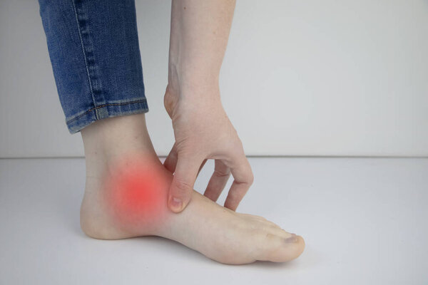 Woman suffering from heel pain. Inflammation or sprain of the tendon in the foot, heel spur, bursitis. The concept of diseases and pains in the leg