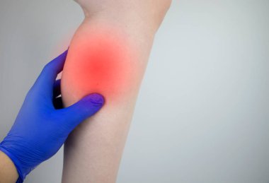 Bir kadın baldırlarında ağrıdan muzdarip. Baldır kasını germek, varis damarları, bacak krampları ya da miyozit. Ortopedi doktoru hastayı muayene ediyor.