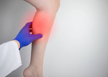 Bir kadın baldırlarında ağrıdan muzdarip. Baldır kasını germek, varis damarları, bacak krampları ya da miyozit. Ortopedi doktoru hastayı muayene ediyor.