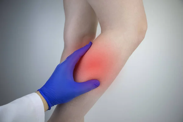 Kvinne Lider Smerter Leggen Strekk Leggmuskelen Åreknuter Leggkramper Eller Myositt – stockfoto