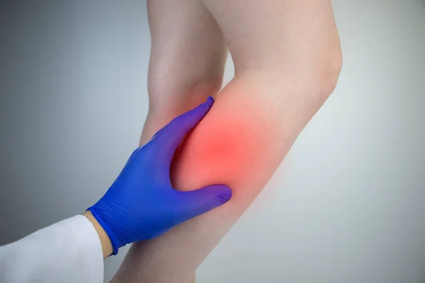 A woman suffers from pain in the calves. Stretching the calf muscle, varicose veins, leg cramps, or myositis. Orthopedic doctor examines patient — Stock Image Woman Suffers Pain Calves Stretching Calf Muscle Varicose Veins Leg Royalty Free Stock Photos