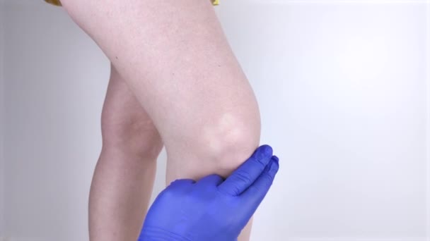 Woman Suffers Knee Pain Examination Orthopedist Traumatologist Redness Swelling Legs — Stock Video