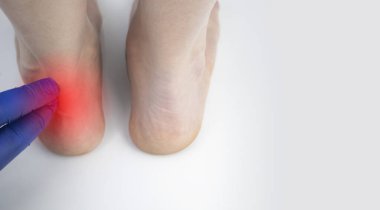 Bir ortopedi doktoru bir kadının bacağını muayene eder. Achilles tendonu ve ayak bileği hastalıkları. Topuk ve ayak iltihabı, achillobursitis ve achillotomy, romatizma, tendon yırtılması.