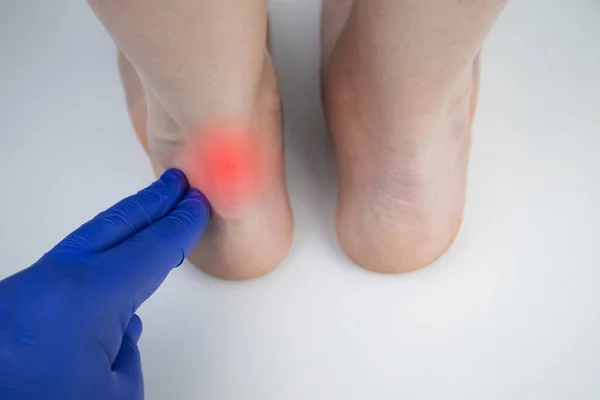 Bir ortopedi doktoru bir kadının bacağını muayene eder. Achilles tendonu ve ayak bileği hastalıkları. Topuk ve ayak iltihabı, achillobursitis ve achillotomy, romatizma, tendon yırtılması.