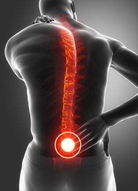 man has pain in back and neck clipart
