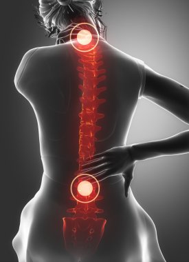 woman has pain in back and neck clipart
