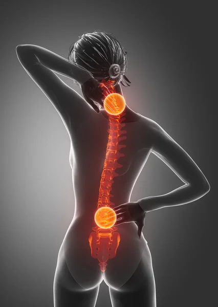 Woman has pain in neck and back — Stock Photo, Image