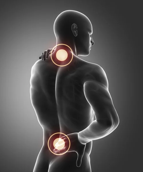 Homem tem dor nas costas e pescoço — Fotografia de Stock