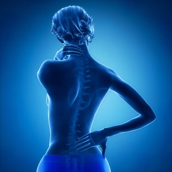 Mujer tiene dolor en el cuello y la espalda — Foto de Stock