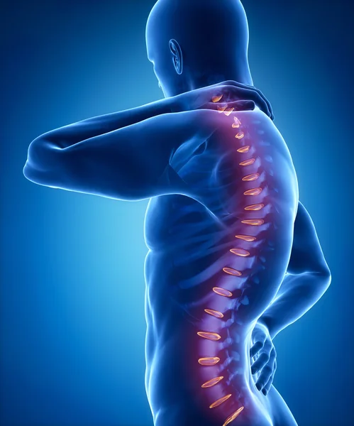 Man has pain in back and neck — Stock Photo, Image