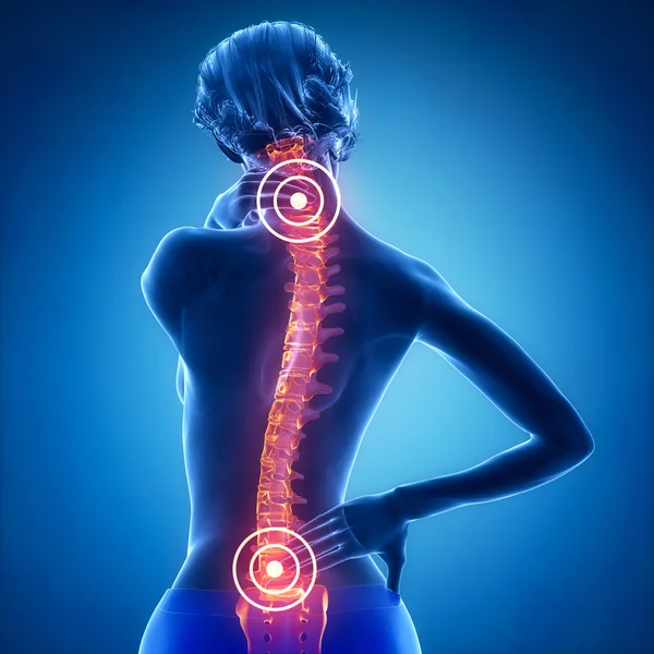Frau hat Nacken- und Rückenschmerzen — Stockfoto