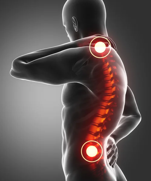 Mann hat Schmerzen in Rücken und Nacken — Stockfoto