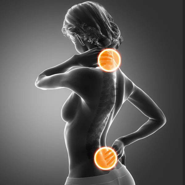 Woman has pain in neck and back — Stock Photo, Image