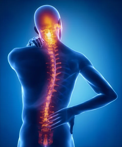 Člověk má bolesti v zádech a krku — Stock fotografie